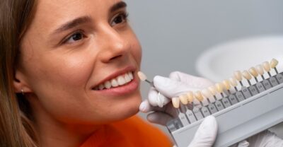 Por qué las carillas dentales son una de las mejores soluciones estéticas Por qué las carillas dentales son una de las mejores soluciones estéticas